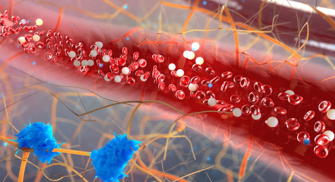 心梗|得了高血脂，不用慌！“一吃一喝”，坚持15天，血脂降了、防心梗