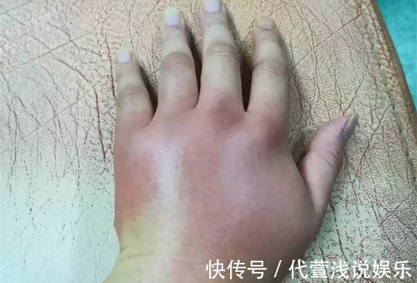 密码|长寿密码就在手上!五脏六腑历历在“手”,男左女右,秘密都在这