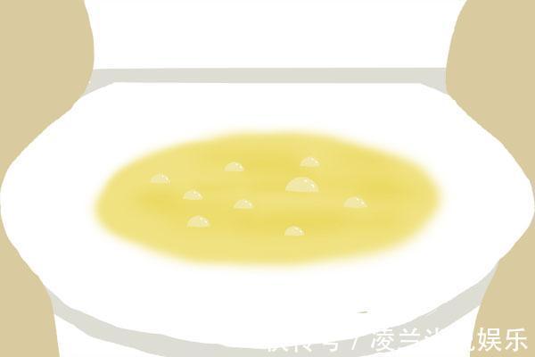 超标|尿酸升高,腿先知?腿部出现哪些异常,说明尿酸或已高到离谱了?