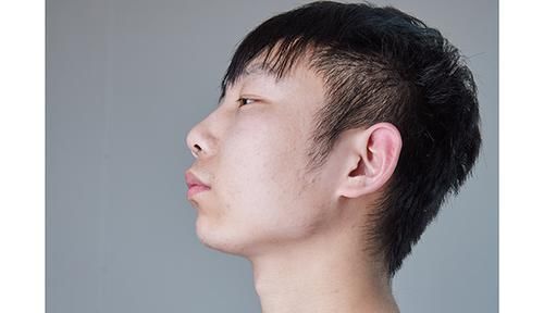 肿瘤|肿瘤医生:身体频繁有3个迹象,或是甲状腺癌“一级预警”