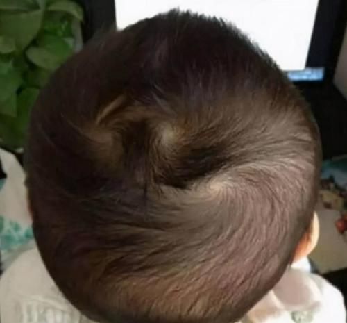 知晓|娃头上“一个旋”和“二个旋”有何区别?影响孩子性格,应知晓