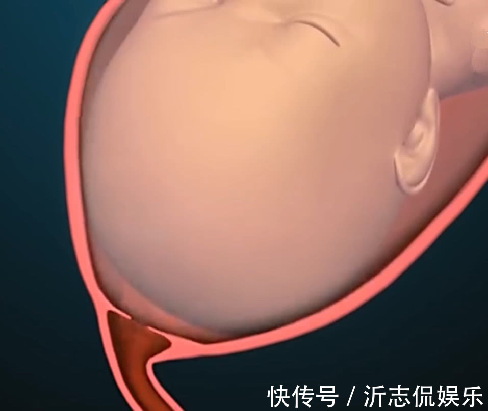 产妇|顺产到底有多“疼”看到第3张图,也许你会明白