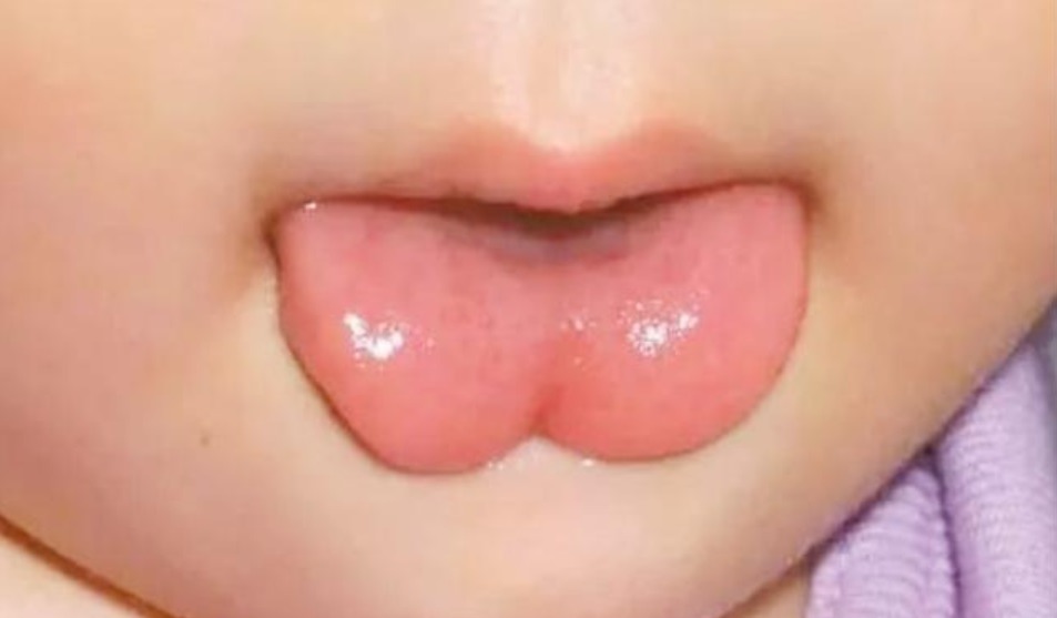 舌根|宝宝不剪“舌根”以后说话不利索?父母别信,很多孩子被害惨