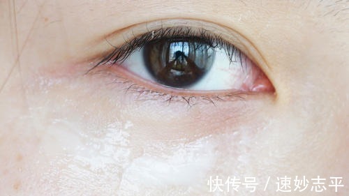 皮肤|脸上长脂肪粒的6大原因,改正这些错误习惯,皮肤变光滑细腻了!