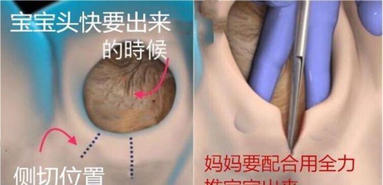 脚印|新生儿出生后在医院留下的''脚印''有啥用?医生不说,父母要知道