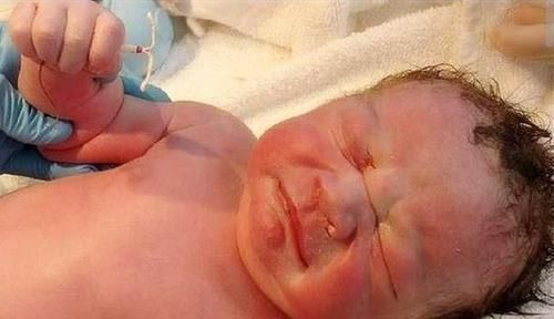 宝妈|婴儿“举着”避孕环出生,带避孕环怀孕的孩子,能不能留下