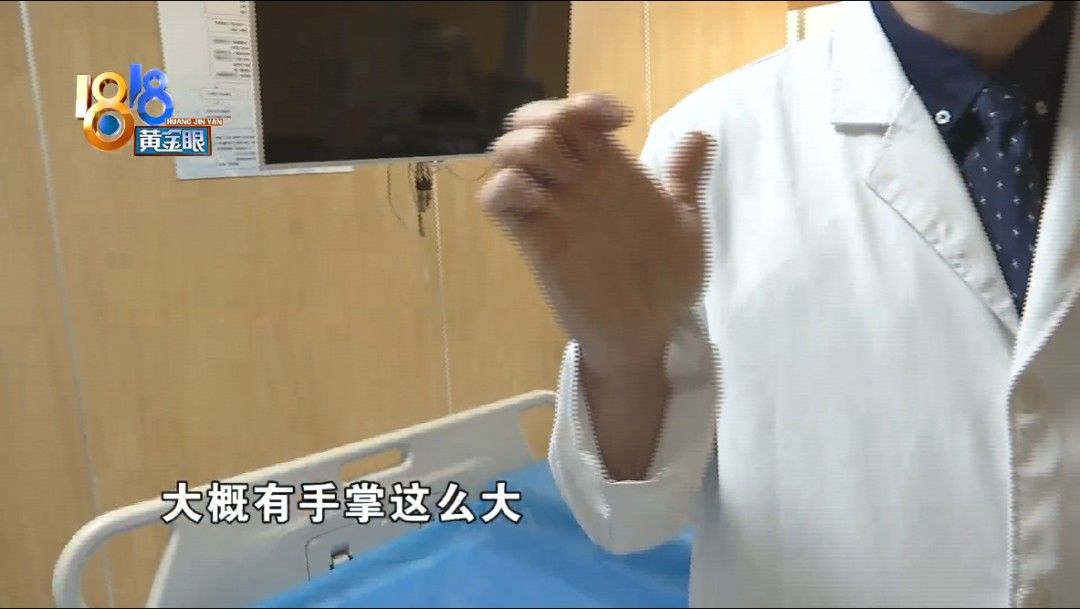 泡椒猪皮|12岁孩子胃部长“肿瘤”，可能跟吃了两年辣条泡面有关