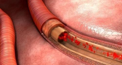 血常规|血常规可以看出是否患有癌细胞吗?听医生怎么说,不妨了解一下