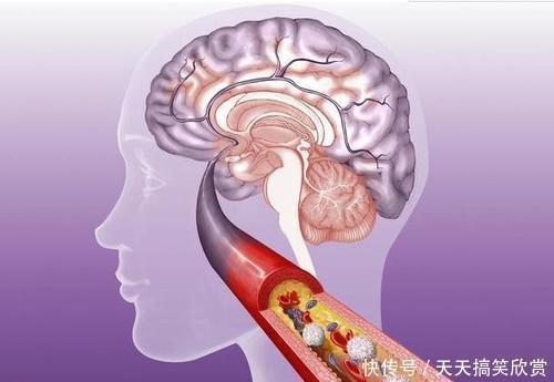 毛细血管|107岁老人,血管仅68岁且不堵,长寿秘诀不是多运动,而是爱做3事