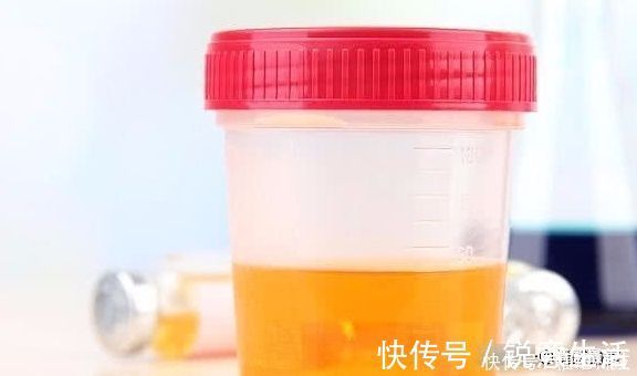 宝宝|怀孕后,宝宝的“性别”不能透露?可参考这3点,据说挺准的