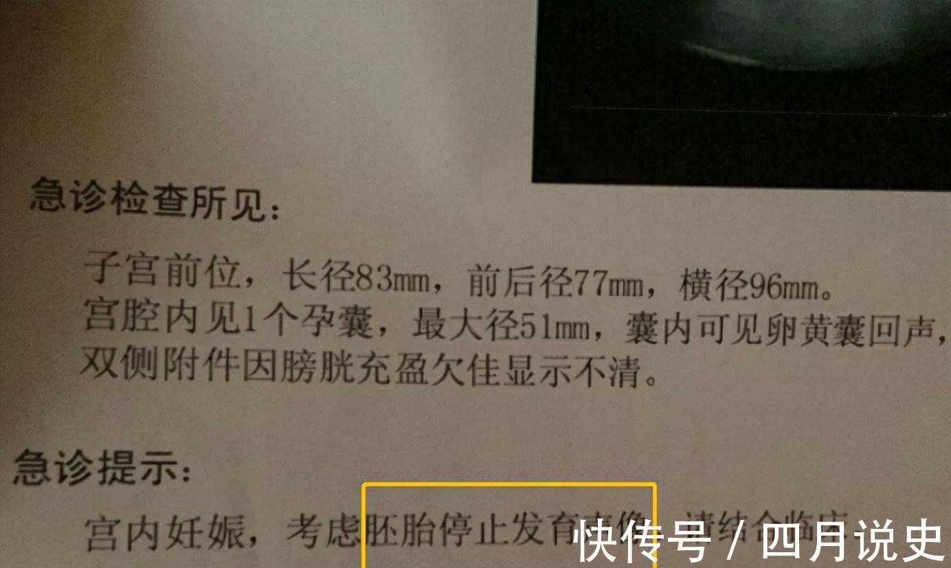 准妈妈|容易“胎停”的准妈妈,怀孕前后都有哪些特点?牢记在心别触底线