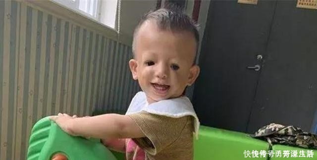 “鸟脸”妈妈不顾劝阻生二胎,二宝没躲过遗传,是任性还是母爱