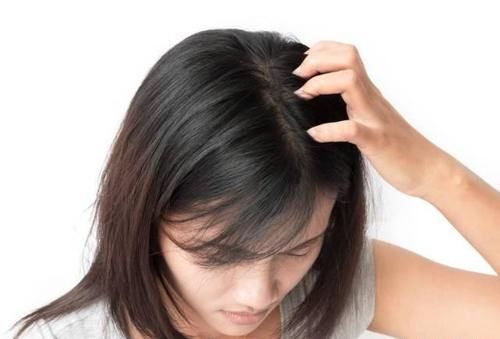 谁说“秃头”没办法改善?教你这5招小秘诀,轻松拯救你的发际线