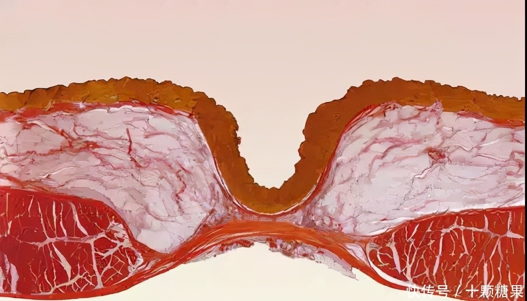 肚脐的黑泥不能清理,否则会进风、漏气、烂肠子?医生辟谣说清楚
