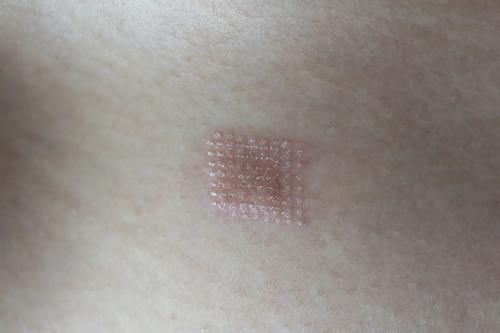 脸上出现4个信号，说明你正在衰老