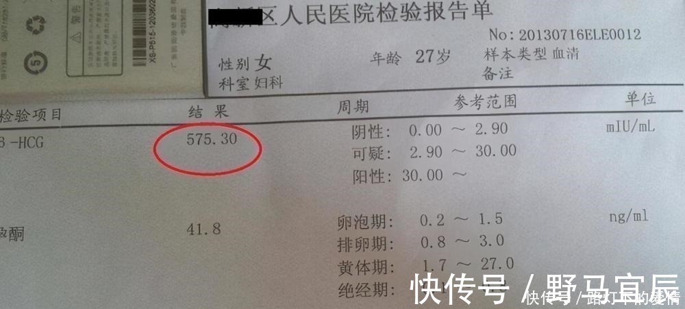 胎心|怀孕后,身体出现这5种反应,可能是“胎停育”,孕妇要立即就医