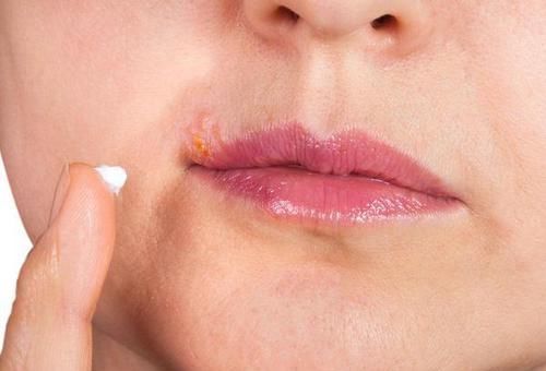 嘴唇干燥起皮，或是这5个原因，很多人都没注意!