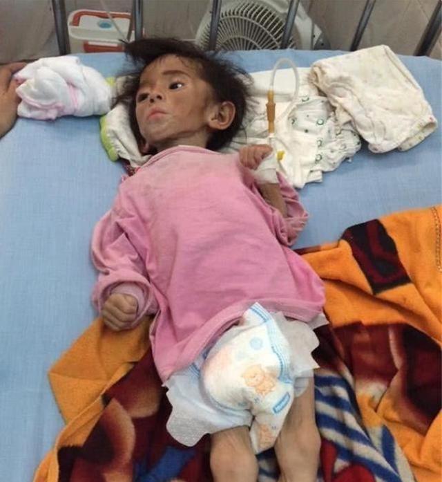 女网红|当年24岁女网红收养“皮包骨”女孩,却充满质疑声,如今怎样了