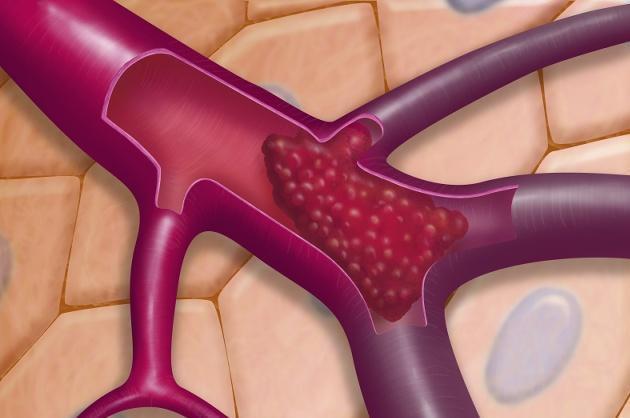 雄激素|男人“雄激素”过低，若常补充4种“物质”，阳气可能越来越足