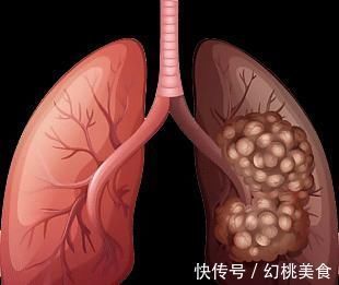 醒来|总是半夜三更醒来,别简单以为是失眠,或是3种疾病来袭,别大意