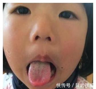 脾胃|孩子睡觉有3个情况,是脾胃虚弱了,家长要上心,3招巧破解