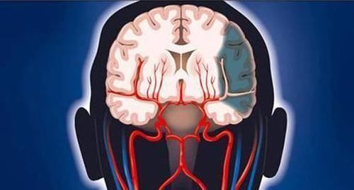 动脉|做好这5件事可稳定血压,警惕高血压对脑组织的3大损害