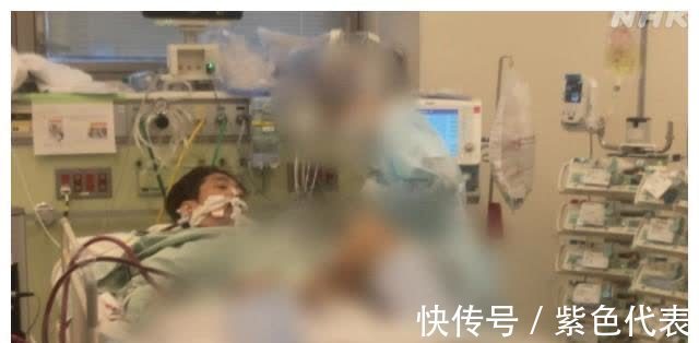 肺部|日本新冠患者2个月的治疗过程 挣扎在生死边缘