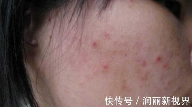 排毒|立秋后,是“排毒黄金期”,身体出现4个症状,说明体内毒素较多