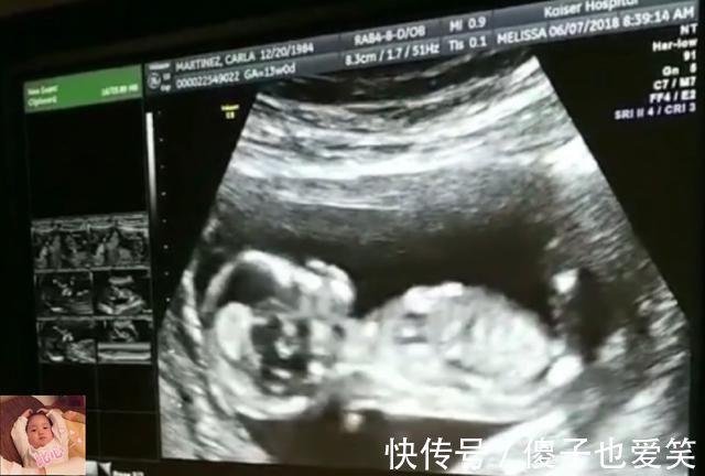 晨练|除了睡觉,胎儿如何每天在肚子里都干啥宝宝小日子开心到飞起