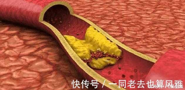 血液|血栓碰上“天敌”了! 常吃让你血管通畅, 血压血脂也正常了