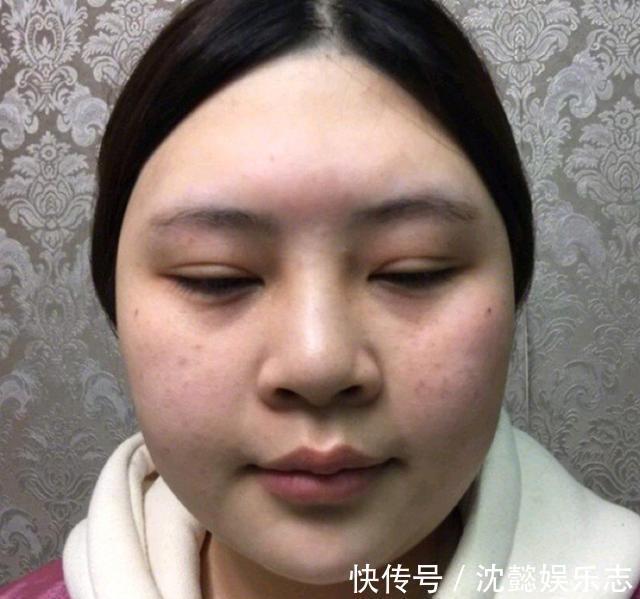 瓜子脸|五种不太受欢迎的“丑”脸型,四方脸还算常见,菱形脸有高级感!