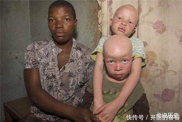 现实版“唐僧”,身处非洲,血液堪比黄金,被警察24小时保护