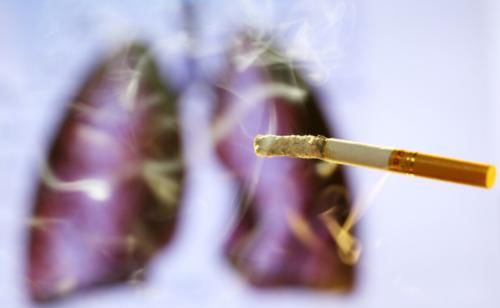 小细胞肺癌|戒烟诱发肺癌？突然戒烟才是肺癌征兆