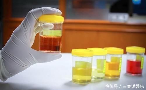 肝病是“拖”出来的，上厕所时出现3种“异常”
