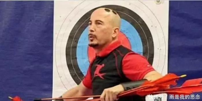 5项最“无聊”的吉尼斯纪录:男子往脑袋上植入天线,有何作用?