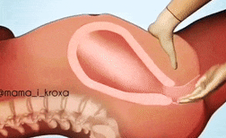 胎盘|生孩子后胎盘是怎样下来的, 看过这组动图你就明白了!