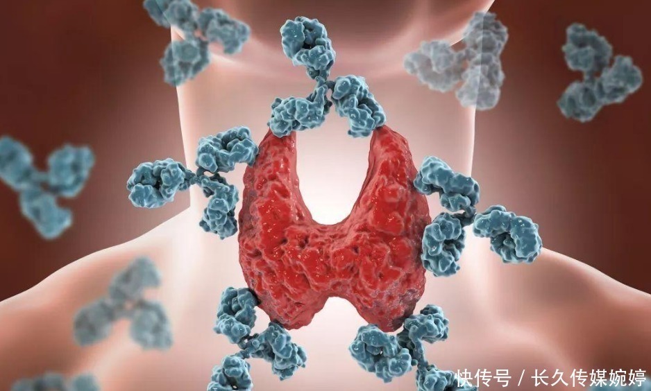 萝卜|甲状腺结节不能吃萝卜?内分泌宁院士:想消散结节,别碰3类食物