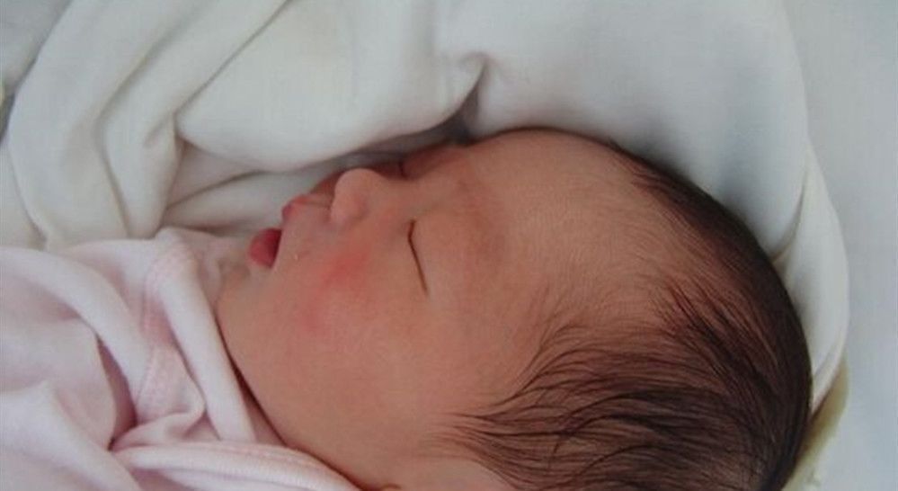 钳印|孩子1岁脸上“产钳印”不消,找医生被反驳,宝妈无言以对