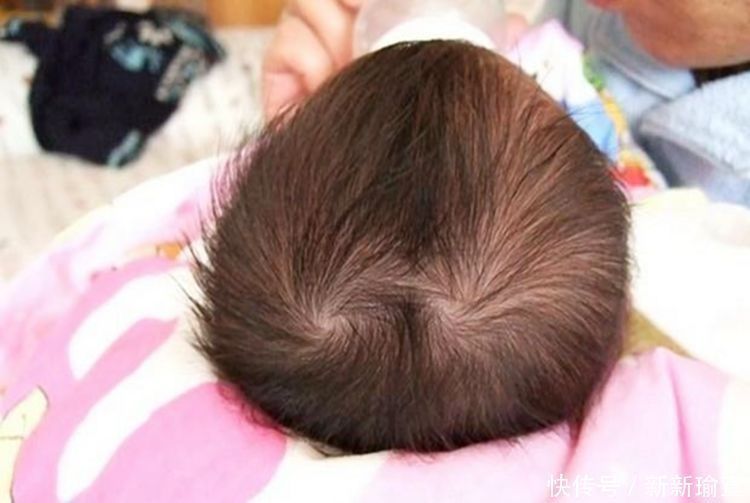 晓雯|孩子头顶上的“两个旋”代表啥?很多父母误解了,看完你就懂了