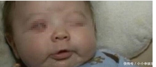 坏习惯|孩子出生就没有眼睛,医生怒斥宝妈谁让你怀孕乱吃的