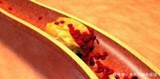 炒蒜苔前用焯水吗难怪蒜苔又硬又不入味,这样做,美味又健康