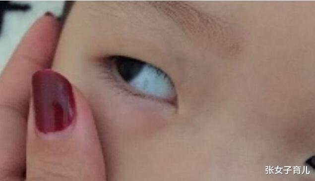 医生|3岁宝宝眼白出现黑点,怎么回事儿听了医生的答案,终于放心了