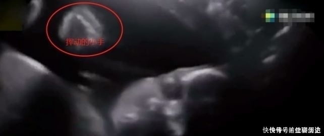 b超|孕妇做B超被吓坏,孩子突然睁眼怪笑!医生却说……