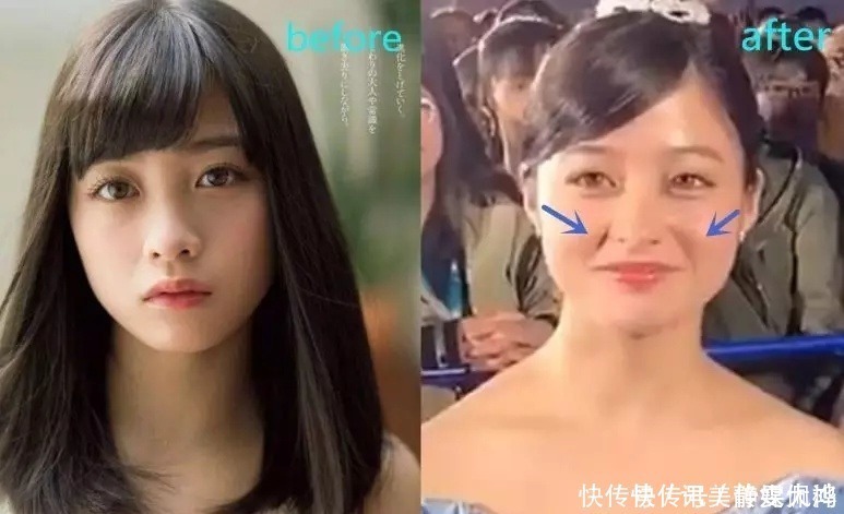 皮相美|面部轮廓有多重要?先轮廓后五官,明星网红的标配