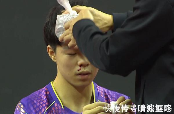 比分|国乒小将意外流鼻血,许昕一脸问号随后表示关心,但仍以4-0获胜