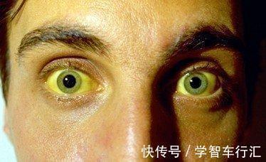 花草茶|肝不好，眼先知！养好肝，谨记：做好3件事、坚持“四个一”