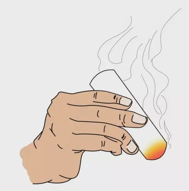 血管外科|艾灸后,绍兴大爷差点截肢 专家:5个老年人里就有一个中招