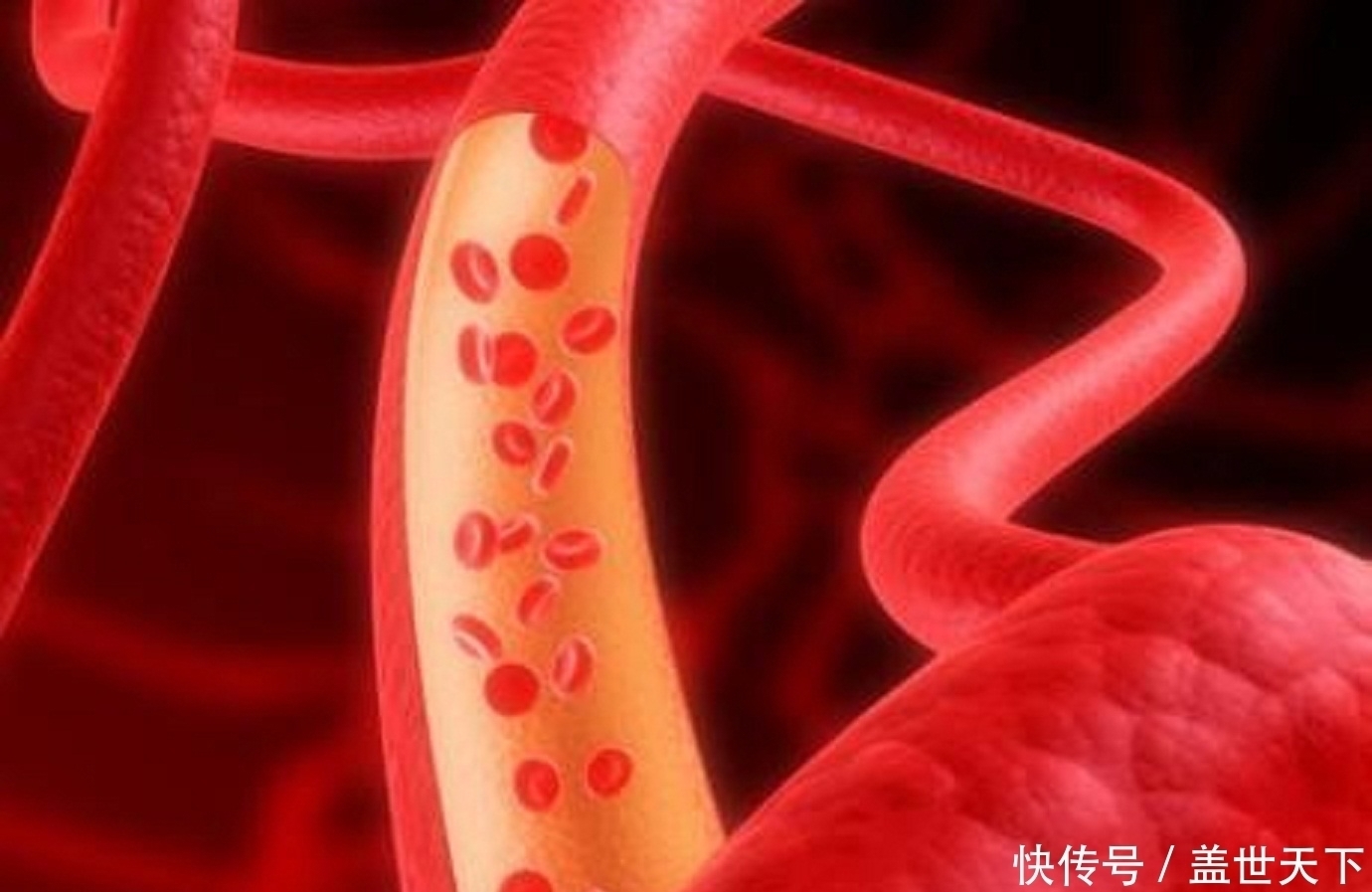 甘油三酯偏高|血脂四项中只是甘油三酯偏高，其它三项正常，这说明了什么问题？