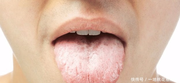 医生提示不论男女,脸上出现4个特征,十有八九是心梗,尽早CT!