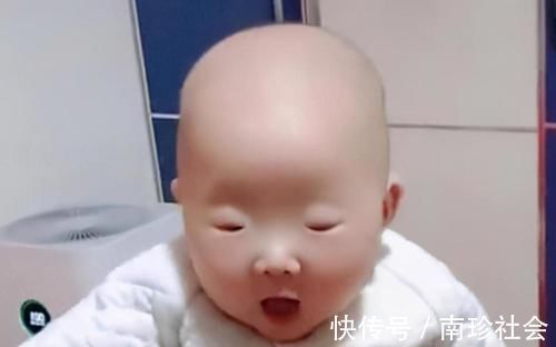 爱美之心|孩子出生眼睛太小,宝妈赶忙去找医生询问,医生却笑了